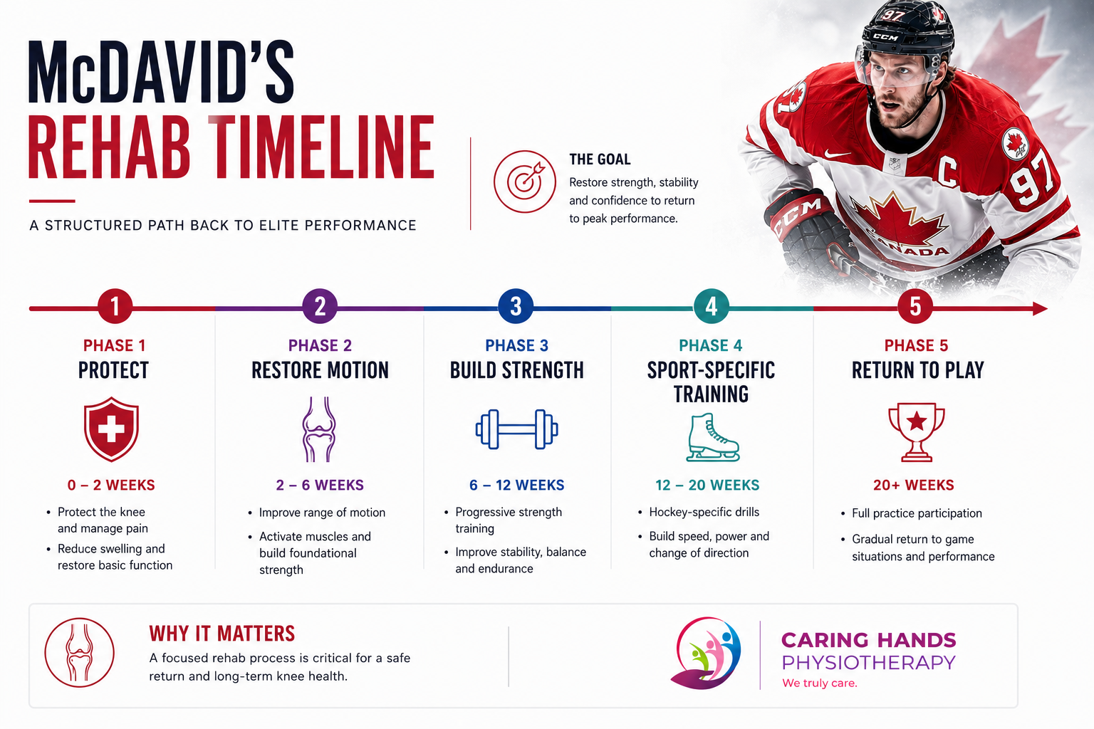 connor-mcdavid-rehab-timeline-infographic Rehabilitation timeline infographic showing the phases of recovery from a PCL tear and tibial plateau fracture inspired by Connor McDavid’s injury recovery.